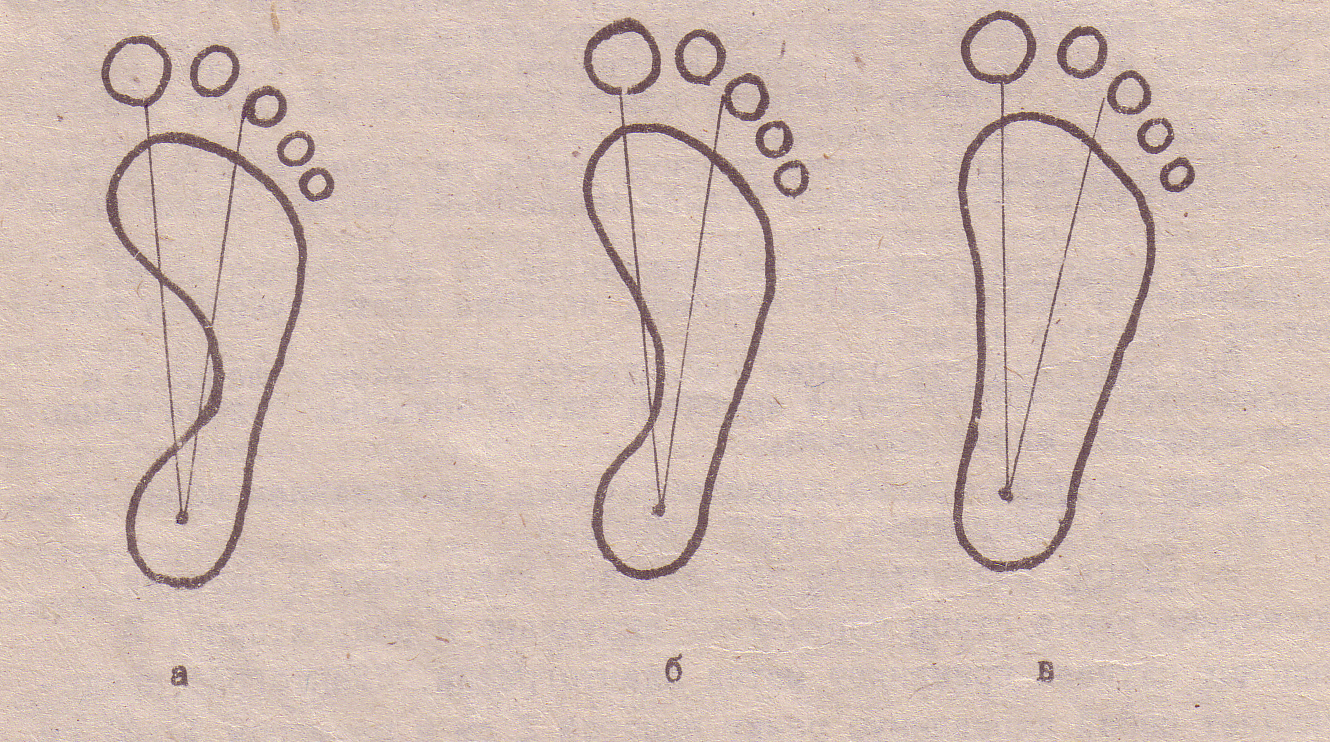 Пайда болу себебі. Плантограмма формула. Отпечаток стопы без плоскостопия. Плантограмма непрямая. Плантографии на листе бумаги.