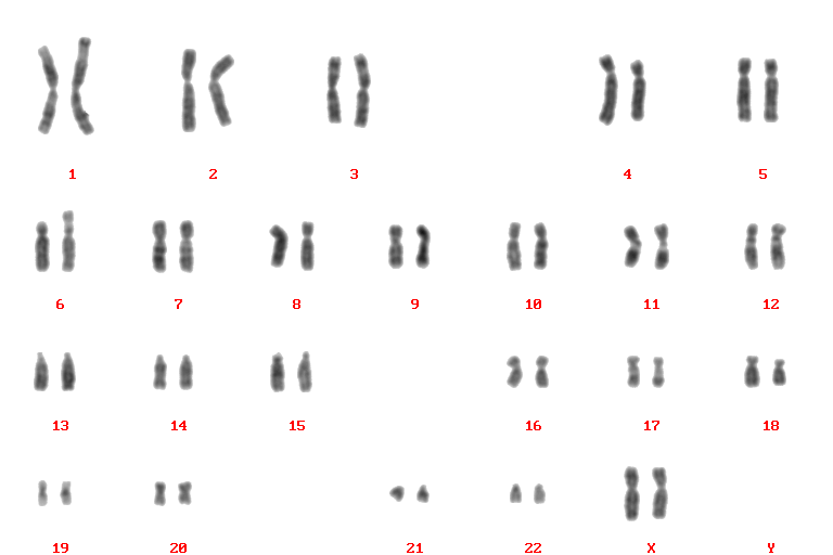 Кариотип человека схема