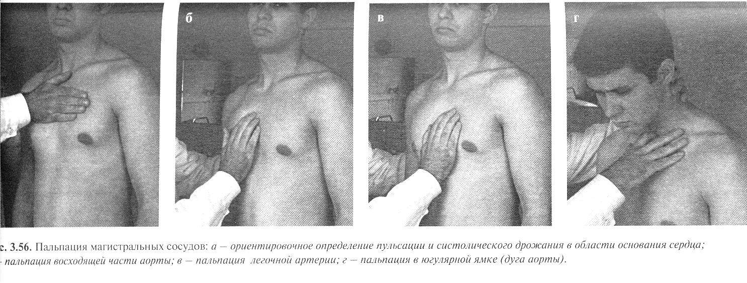 Пальпация сердца. Пальпация магистральных сосудов.