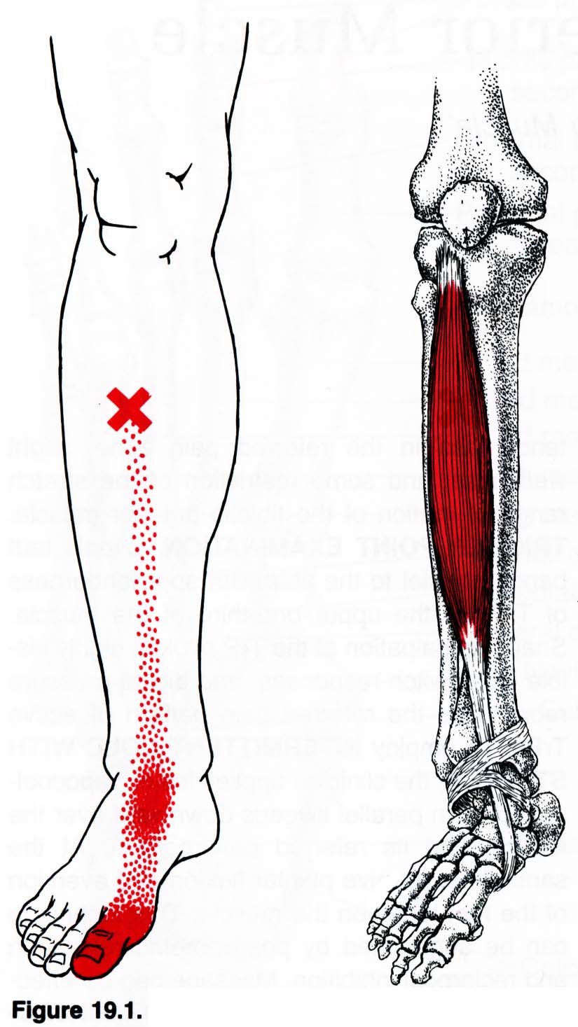 Болит нога кость большая. Триггерные точки большеберцовой мышцы. Задняя большеберцовая мышца триггерные точки. Триггерные точки голени. Триггерные точки голеностопного сустава.